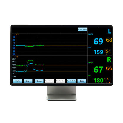 Monitoreo hemodinámico no invasivo <br> VenArt